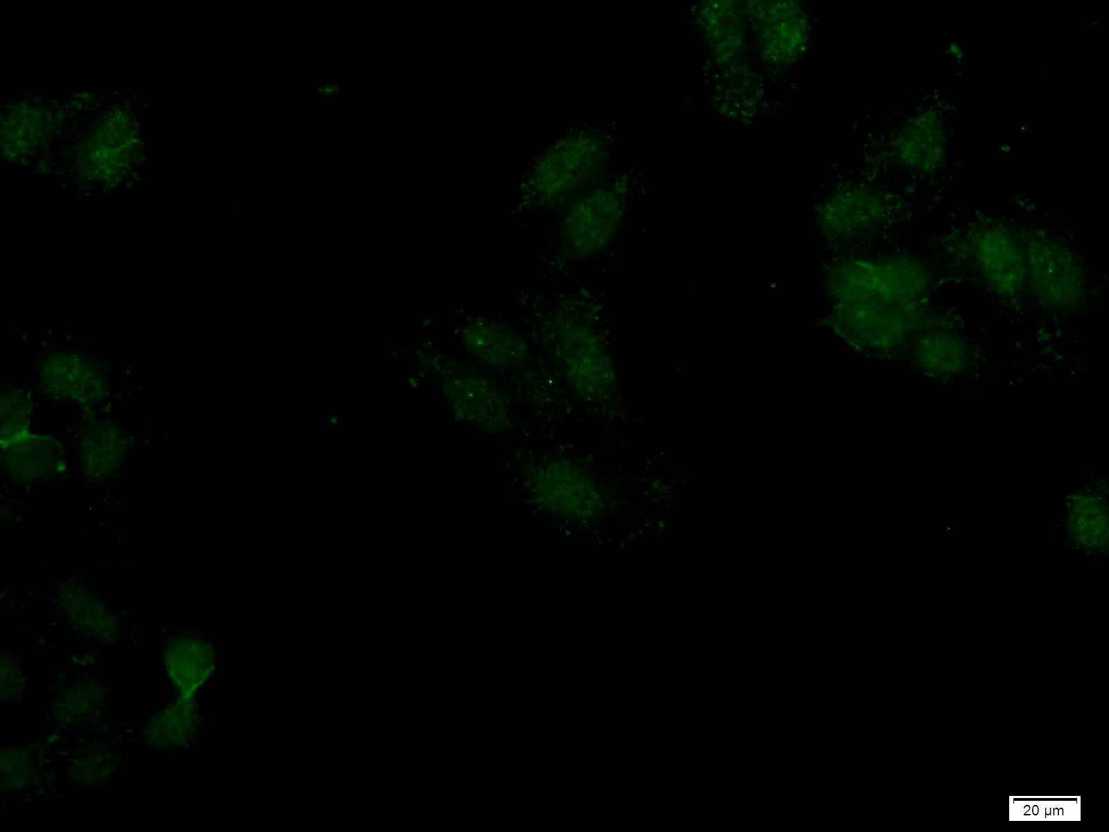 IF Staining of HepG2 using 22009-1-AP