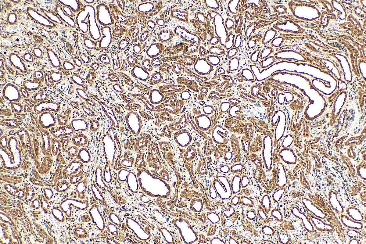 IHC staining of human kidney using 22009-1-AP