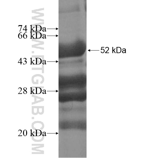 SAMD4A fusion protein Ag10952 SDS-PAGE SAMD4A fusion protein Ag10952 SDS-PAGE