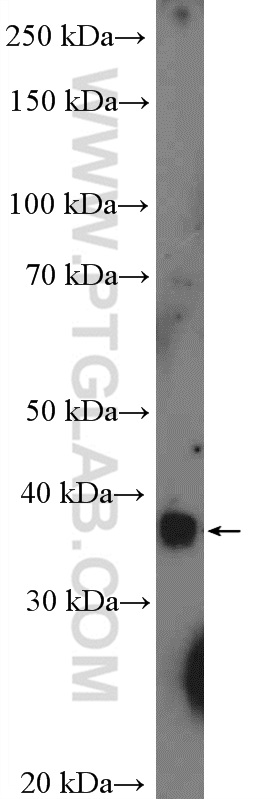 WB analysis of mouse heart using 26815-1-AP