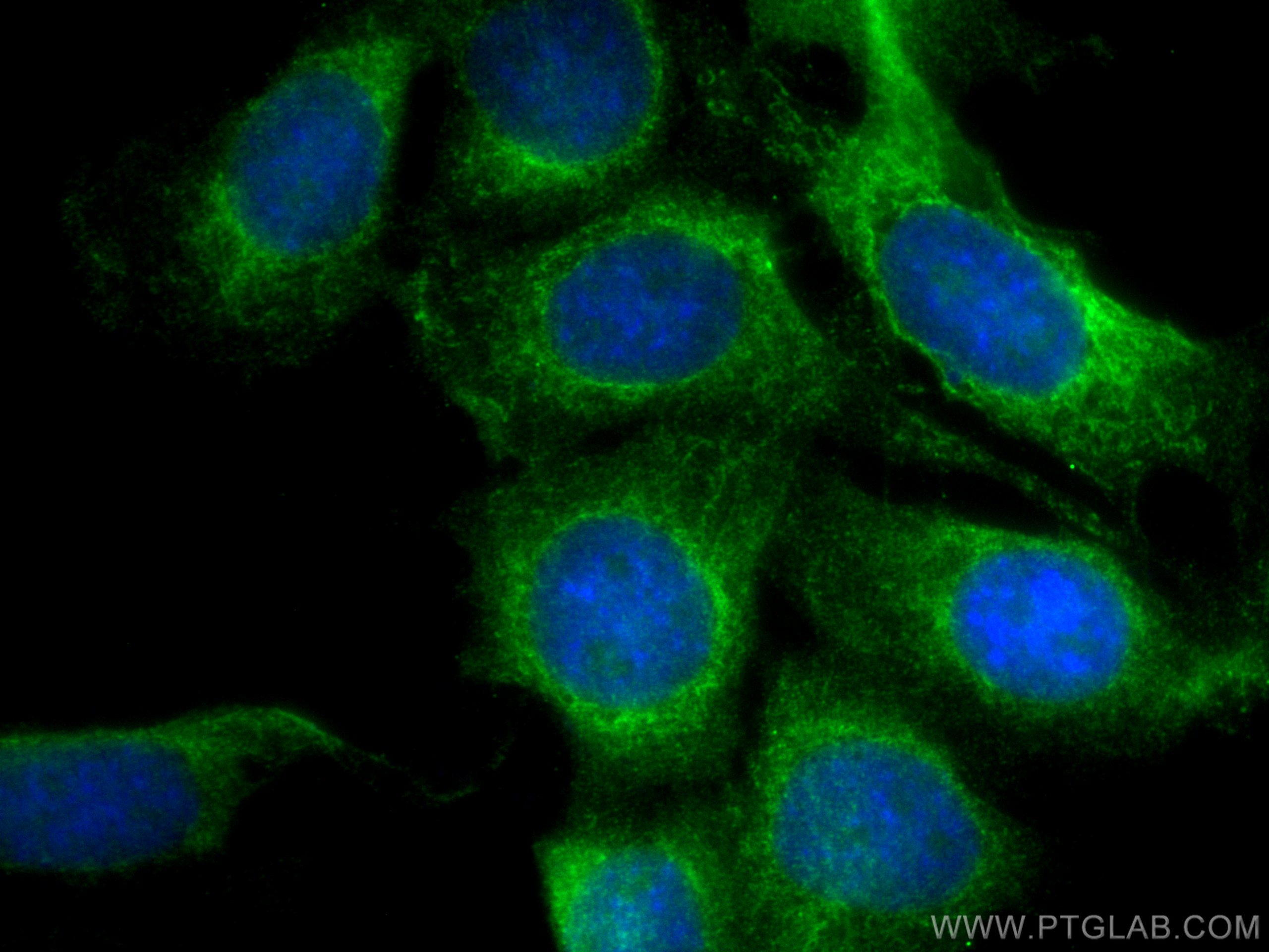 IF Staining of 3T3-L1 using 25173-1-AP