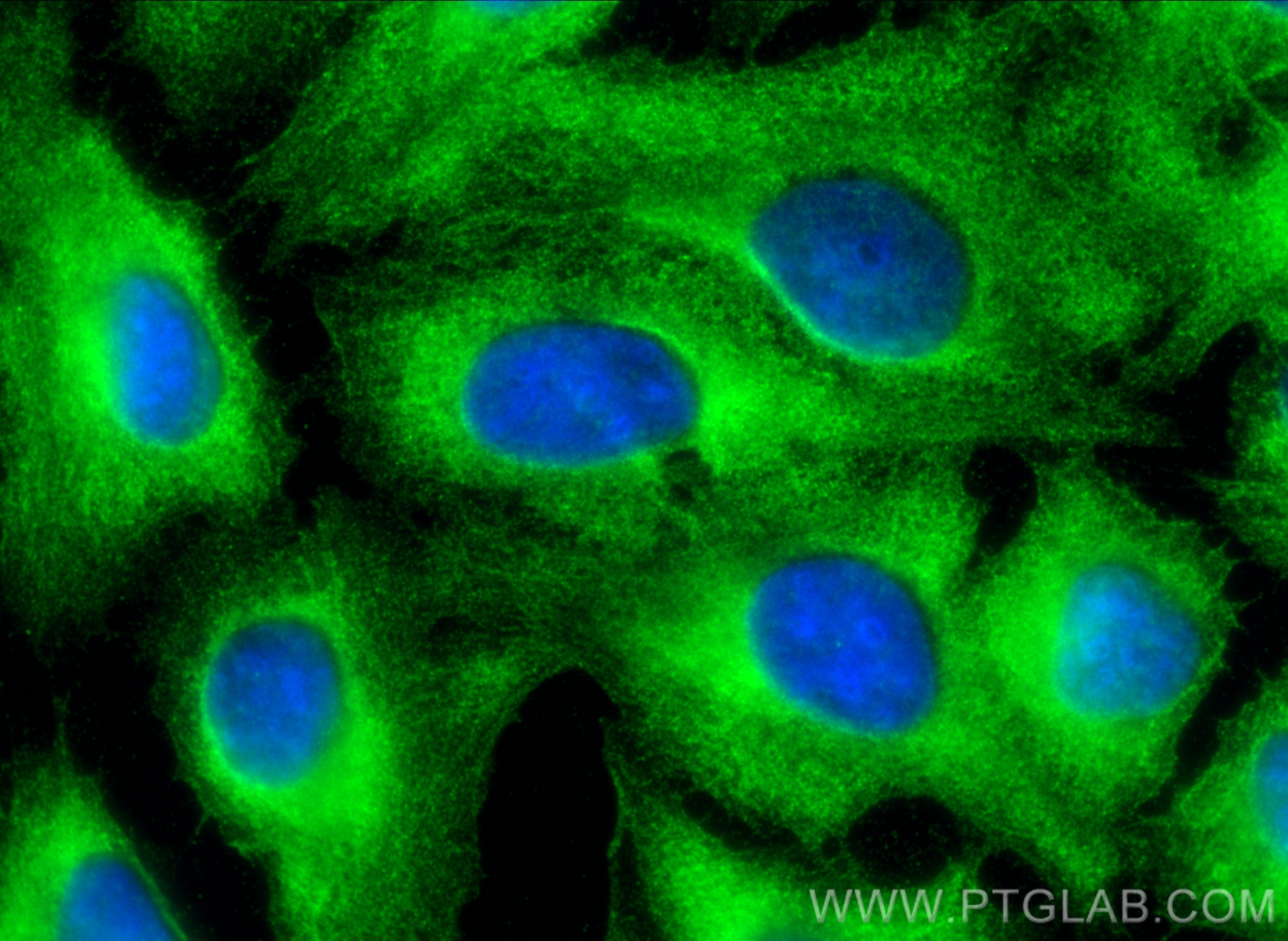 IF Staining of U2OS using 25173-1-AP