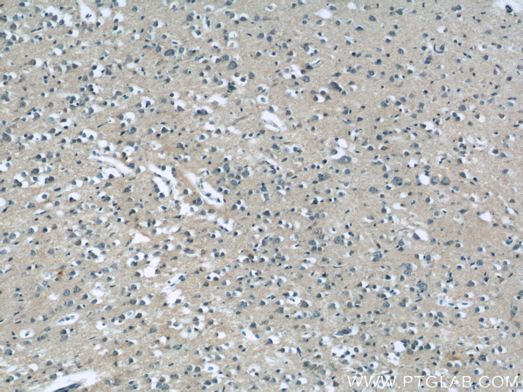 IHC staining of human brain using 25173-1-AP