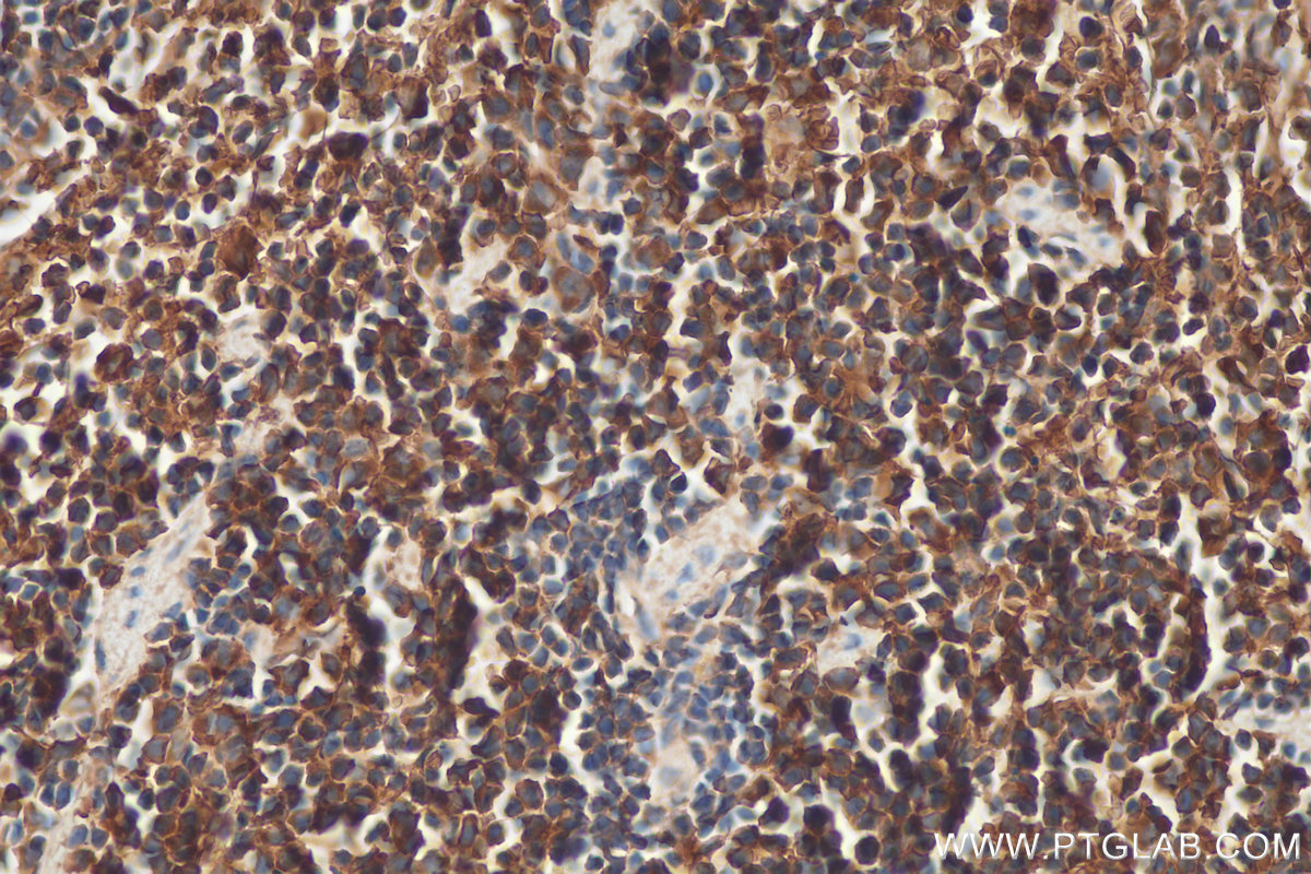 IHC staining of mouse spleen using 25173-1-AP