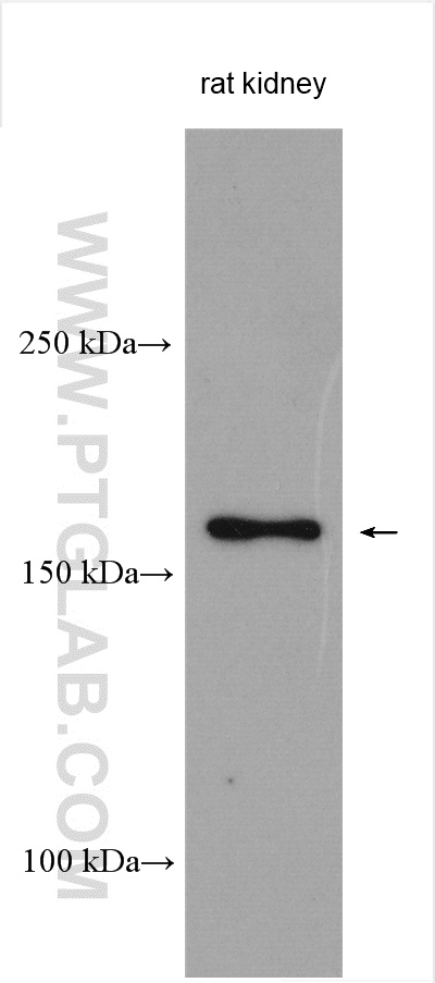 WB analysis using 25173-1-AP