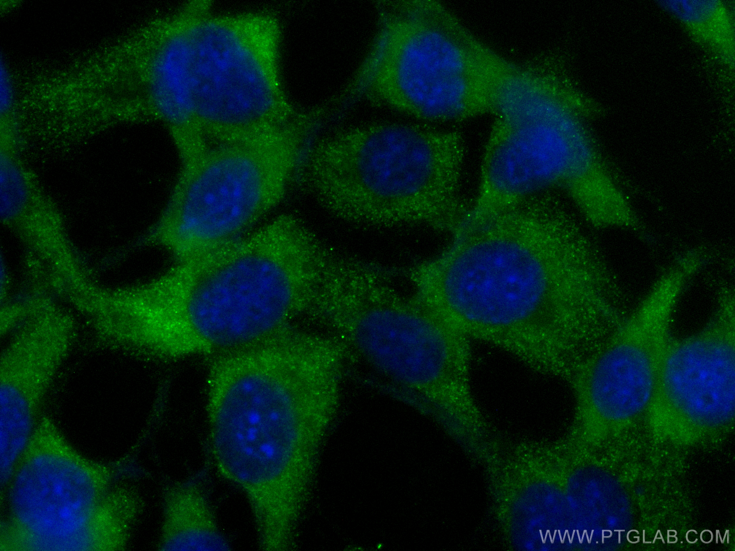 IF Staining of 3T3-L1 using CL488-25173
