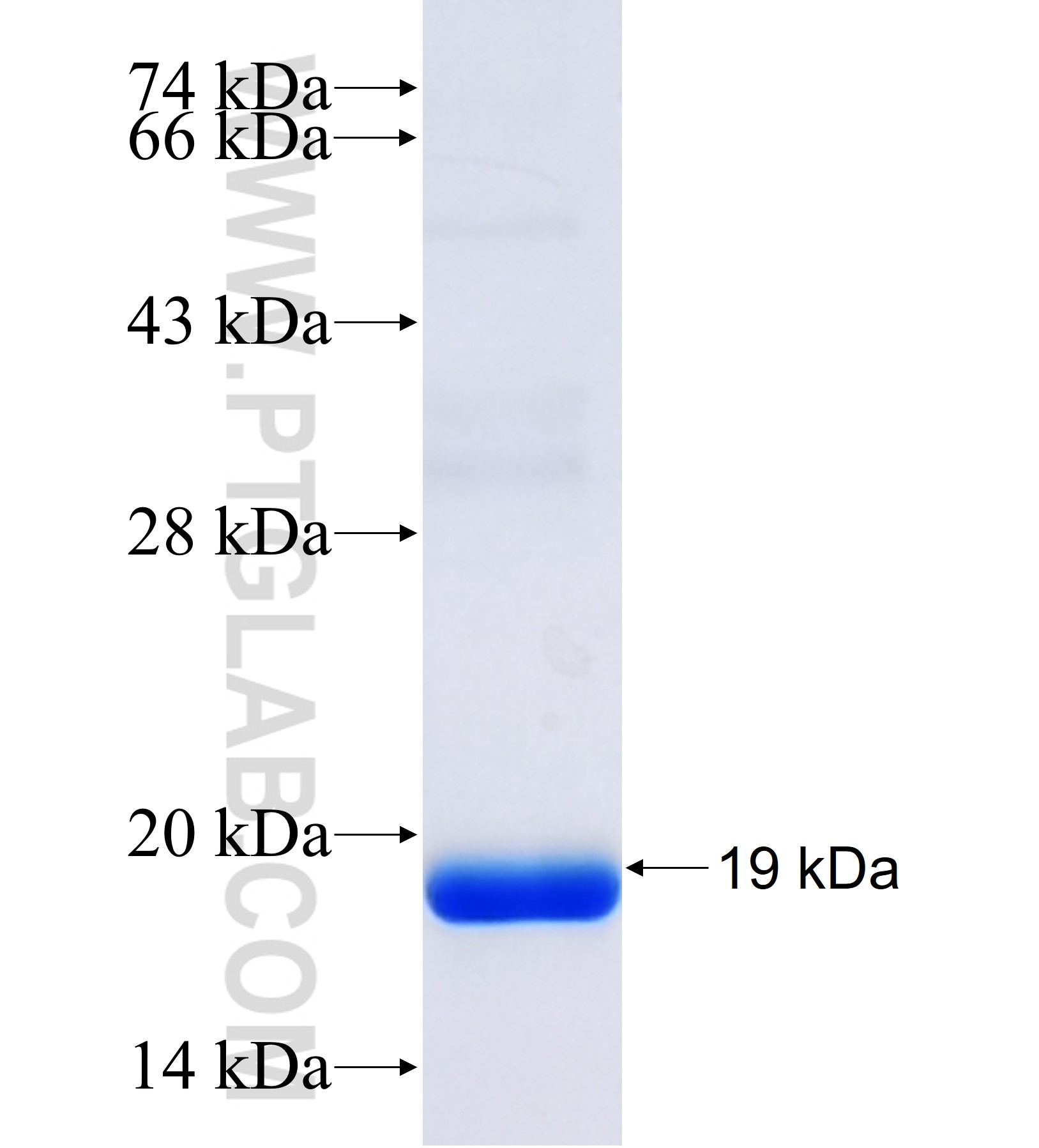 SAMD9L fusion protein Ag41454 SDS-PAGE