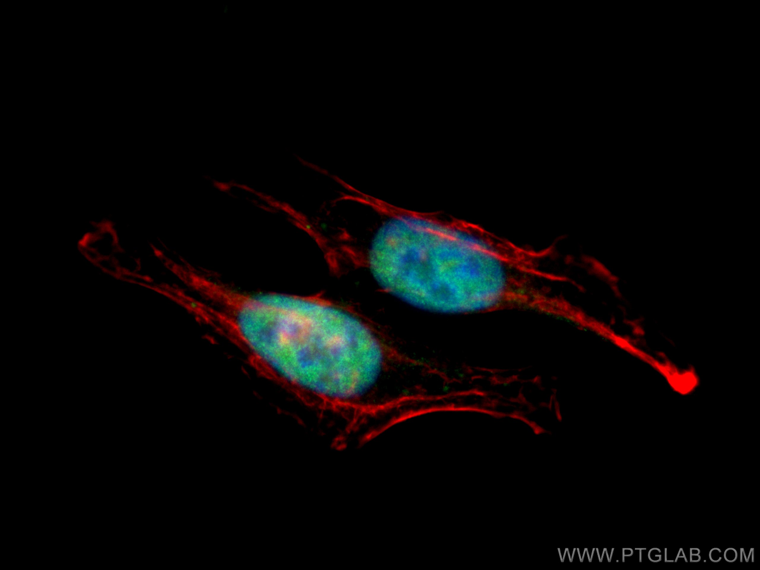 IF Staining of HepG2 using 12586-1-AP