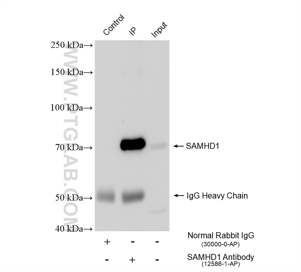IP result of anti-SAMHD1 (IP:12586-1-AP, 4ug; Detection:12586-1-AP 1:3000) with K-562 cells lysate 2440 ug. IP experiment of K-562 using 12586-1-AP