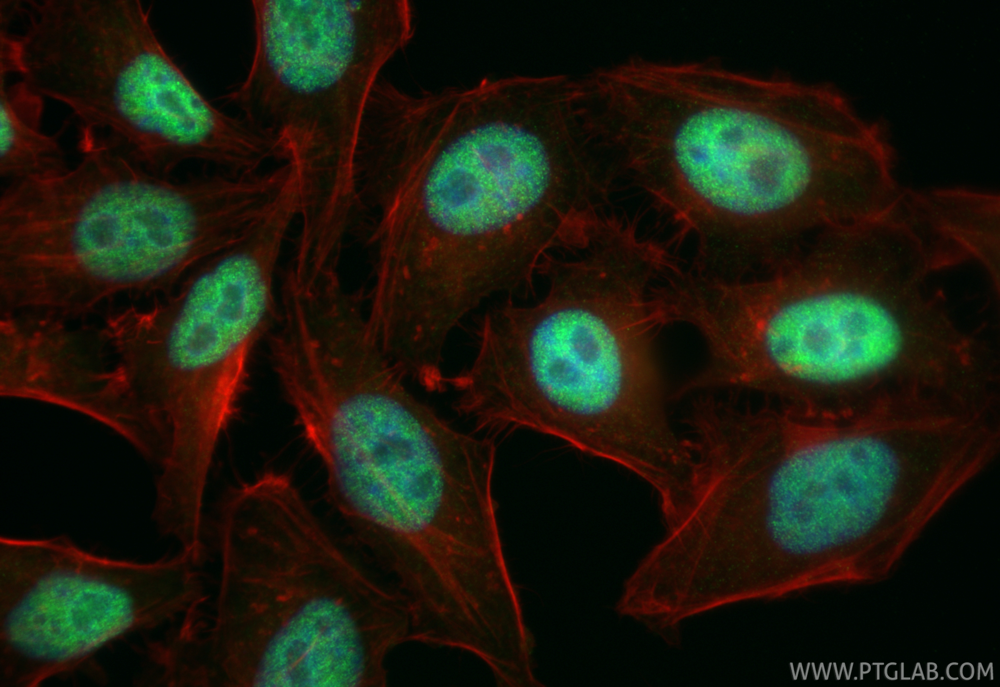 IF Staining of HepG2 using RMX00060