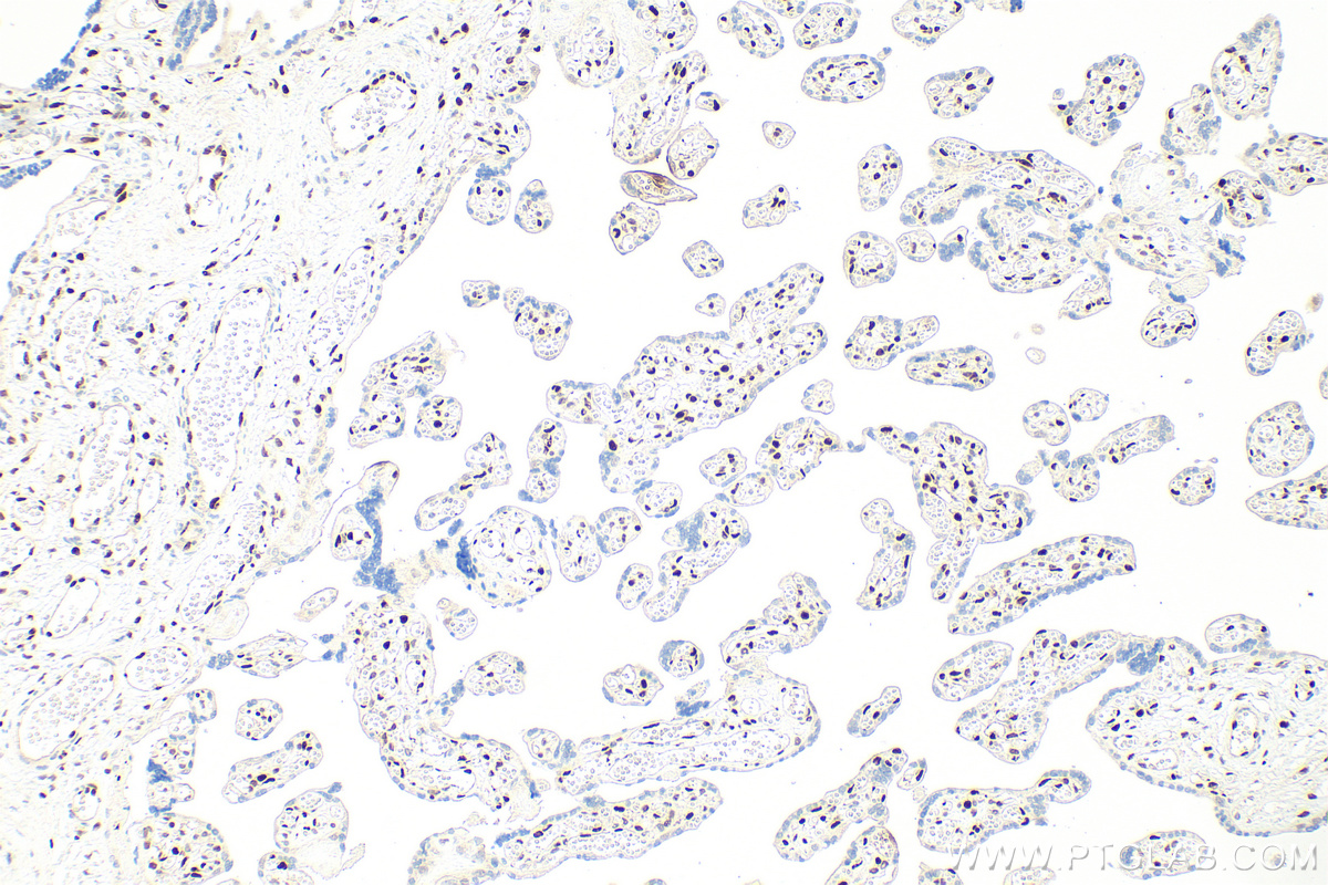 IHC staining of human placenta using RMX00060