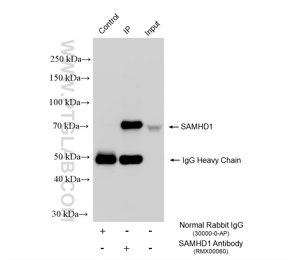 IP experiment of K-562 using RMX00060