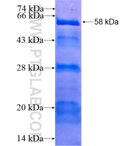 SAMSN1 fusion protein Ag15175 SDS-PAGE