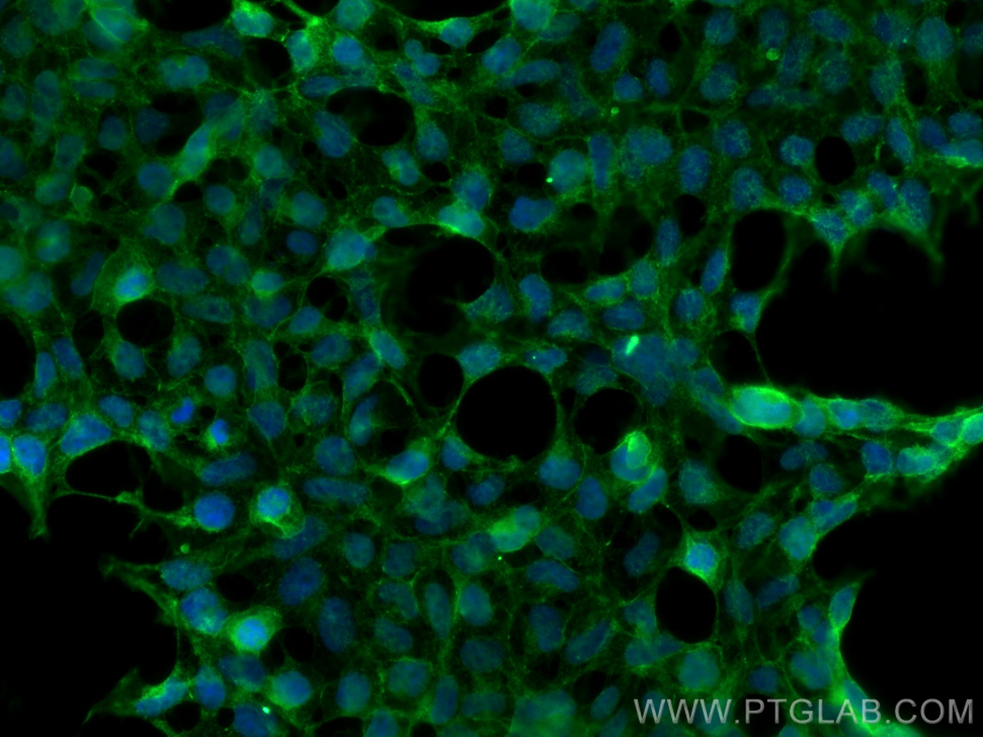 IF Staining of HEK-293 using 29292-1-AP