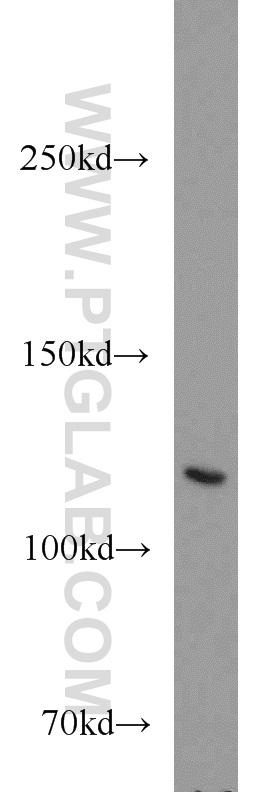 WB analysis of mouse lung using 55085-1-AP