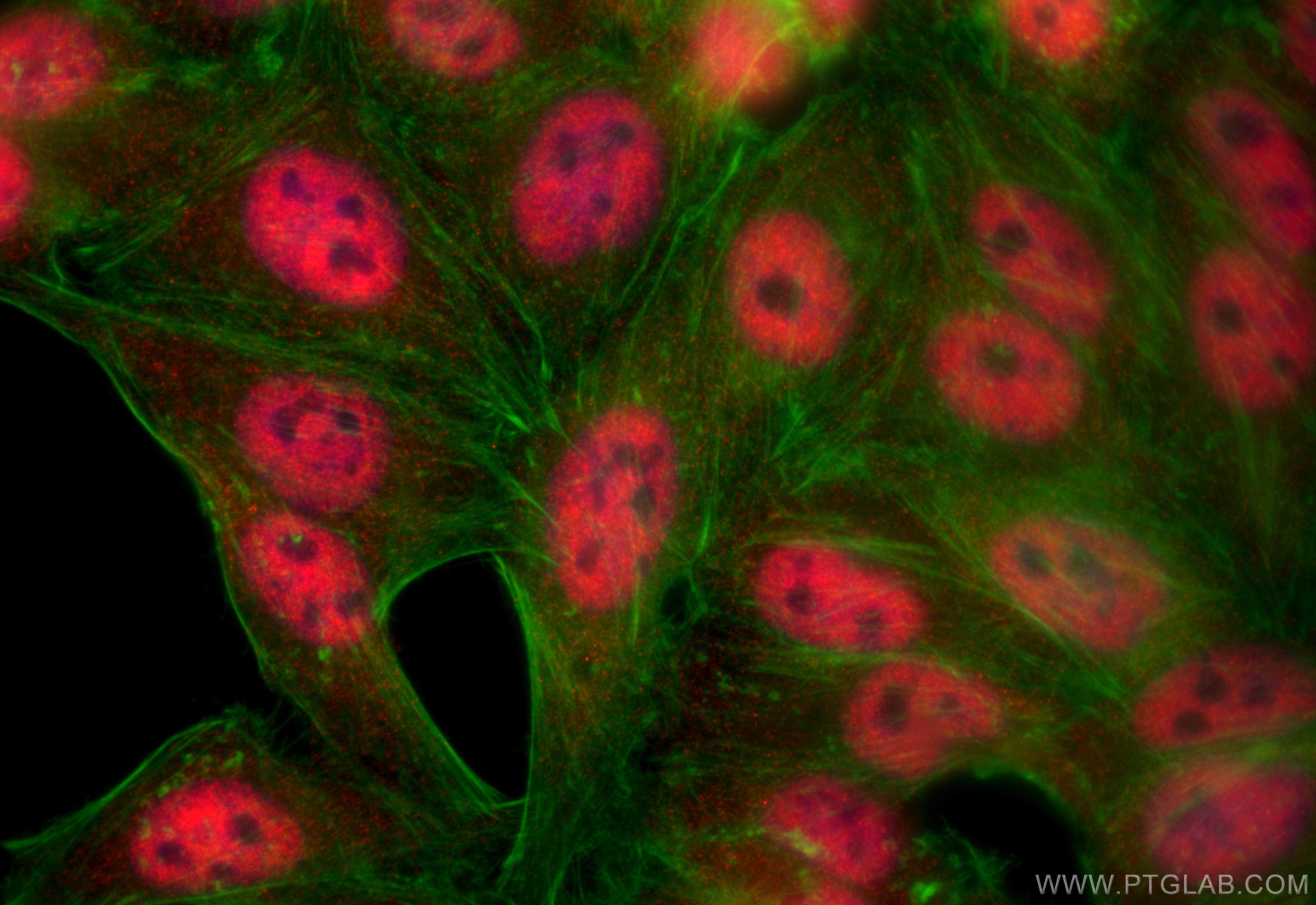 IF Staining of HepG2 using 12130-1-AP