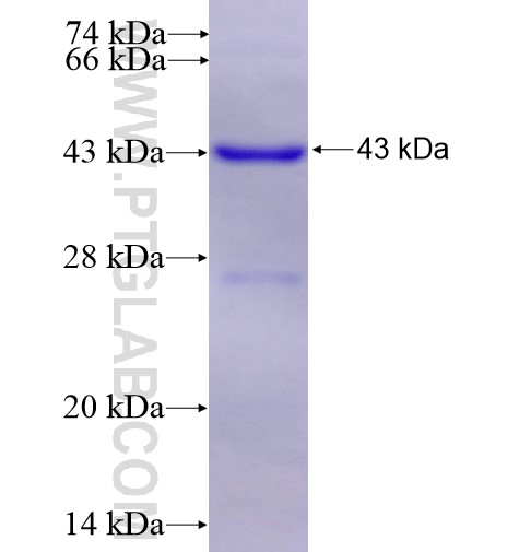 SAP130 fusion protein Ag15274 SDS-PAGE SAP130 fusion protein Ag15274 SDS-PAGE