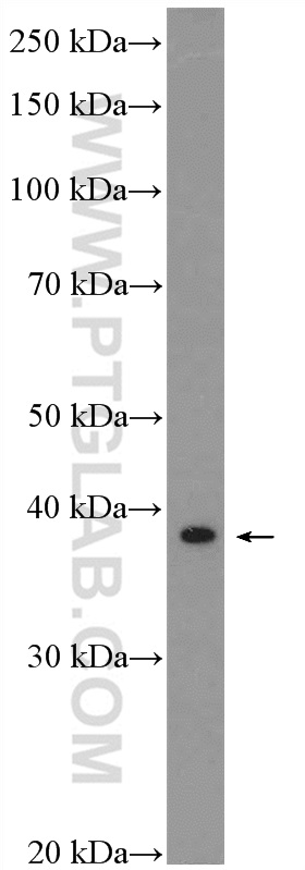 WB analysis of mouse spleen using 20943-1-AP