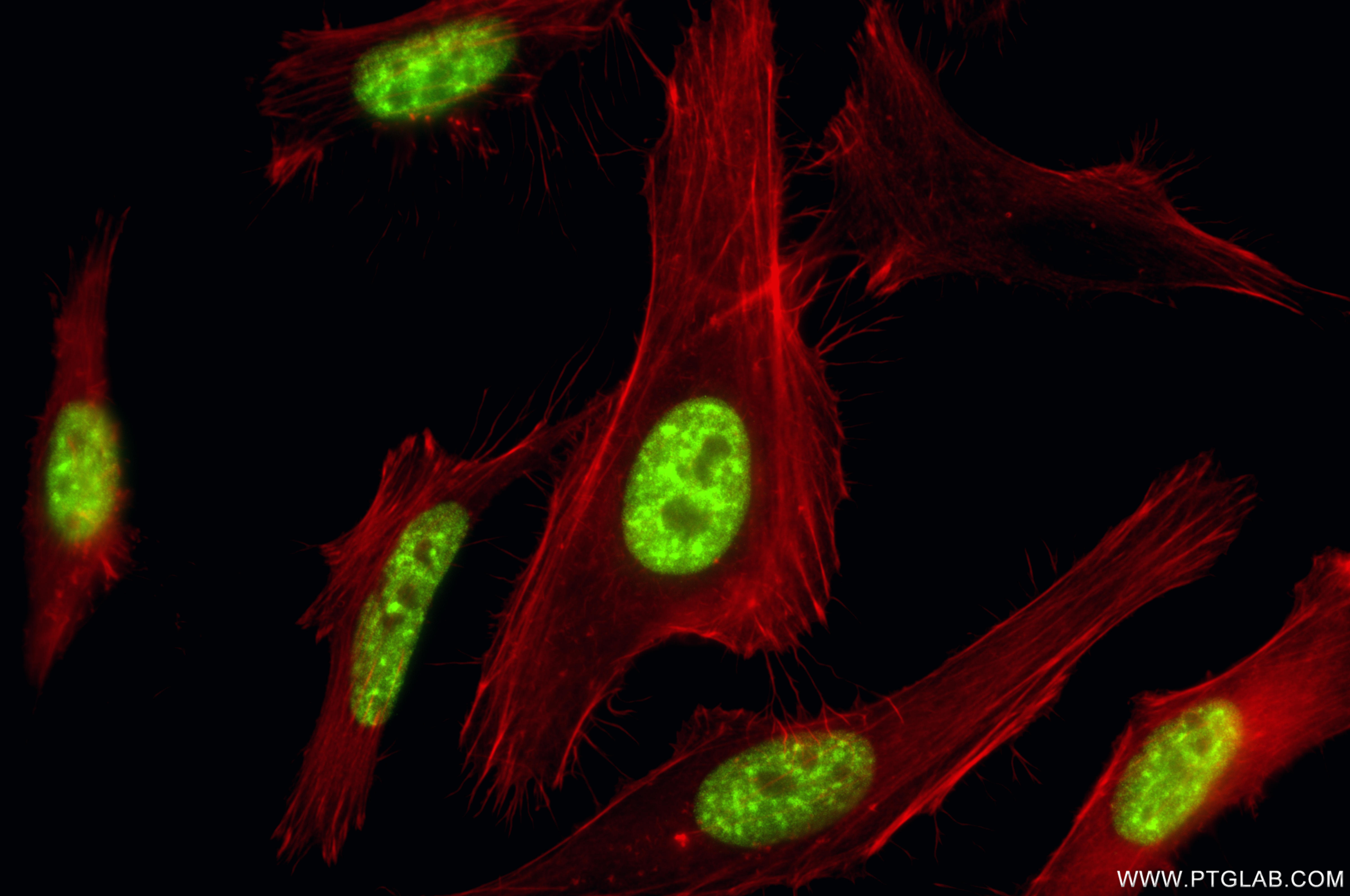 IF Staining of HeLa using 87054-1-RR