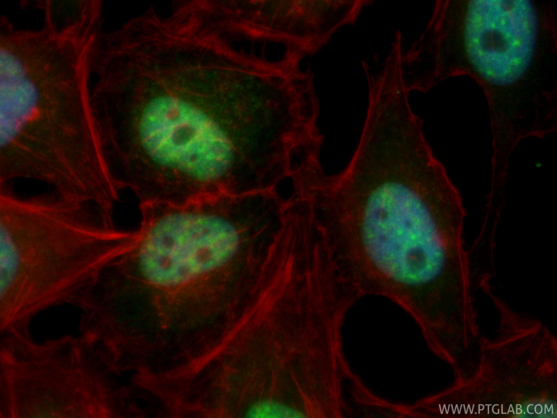 IF Staining of HeLa using CL488-87054 IF Staining of HeLa using CL488-87054