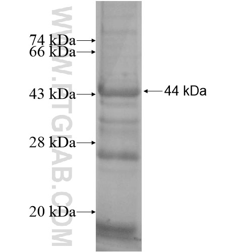 SAP30BP fusion protein Ag15156 SDS-PAGE