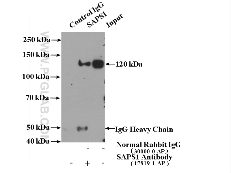 IP experiment of HeLa using 17819-1-AP