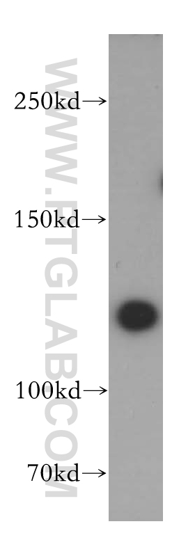 WB analysis of HeLa using 17819-1-AP