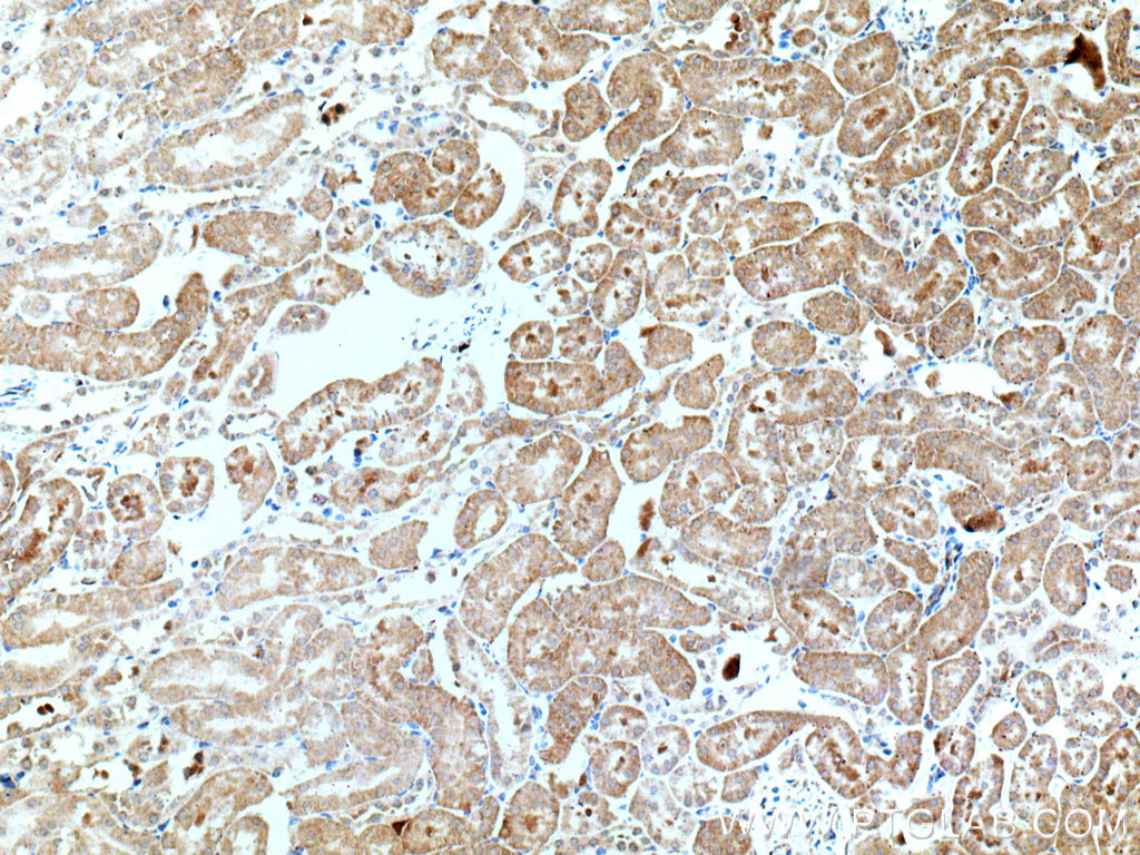 IHC staining of mouse kidney using 16944-1-AP