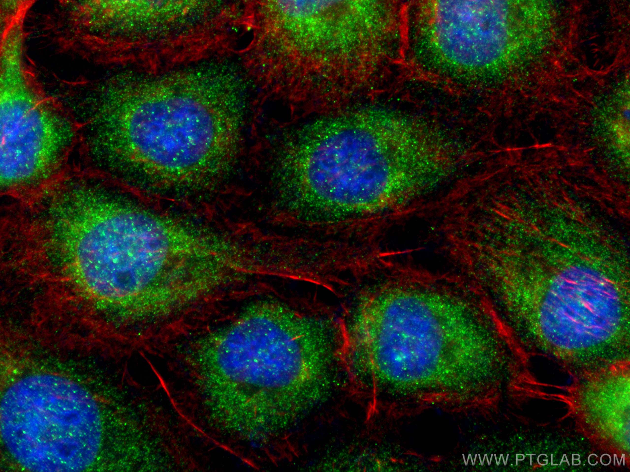 IF Staining of A431 using 22291-1-AP