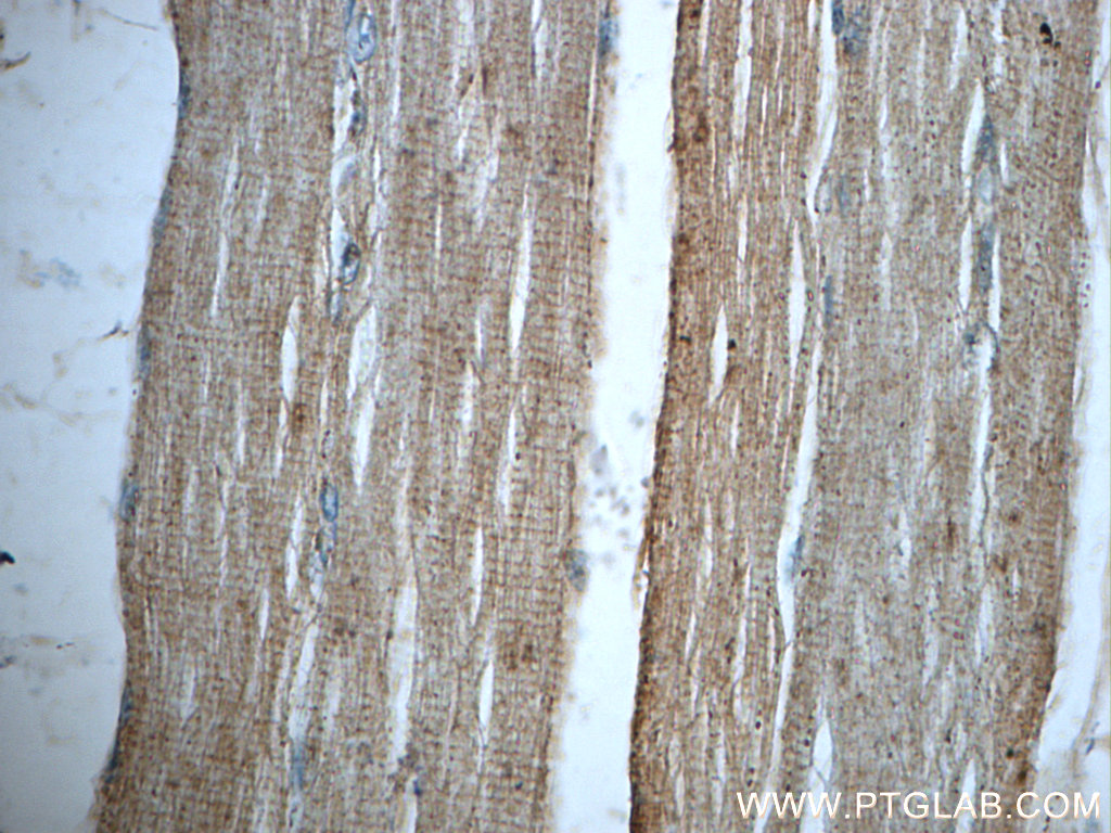 IHC staining of human skeletal muscle using 22291-1-AP