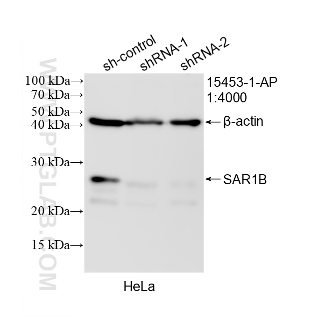WB analysis of HeLa using 15453-1-AP