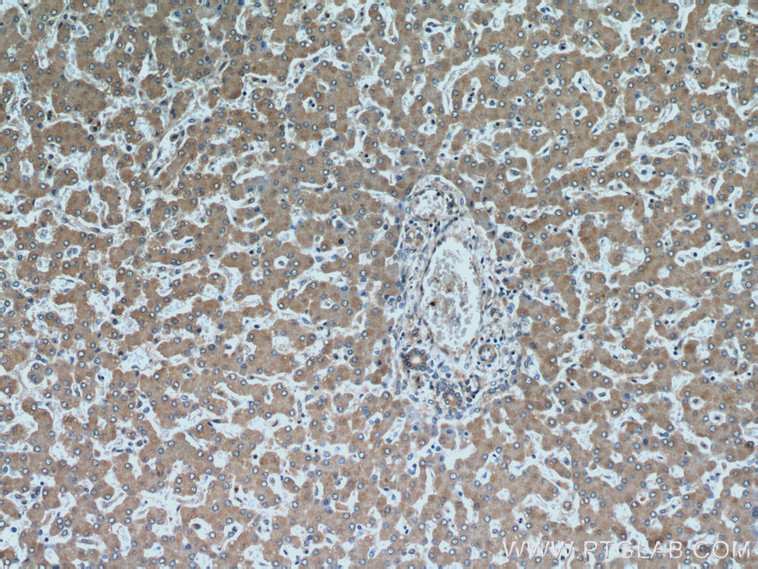 IHC staining of human liver using 22292-1-AP