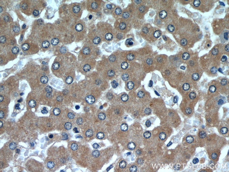 IHC staining of human liver using 22292-1-AP