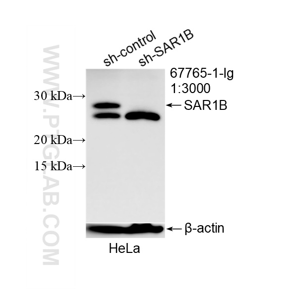 WB analysis of HeLa using 67765-1-Ig