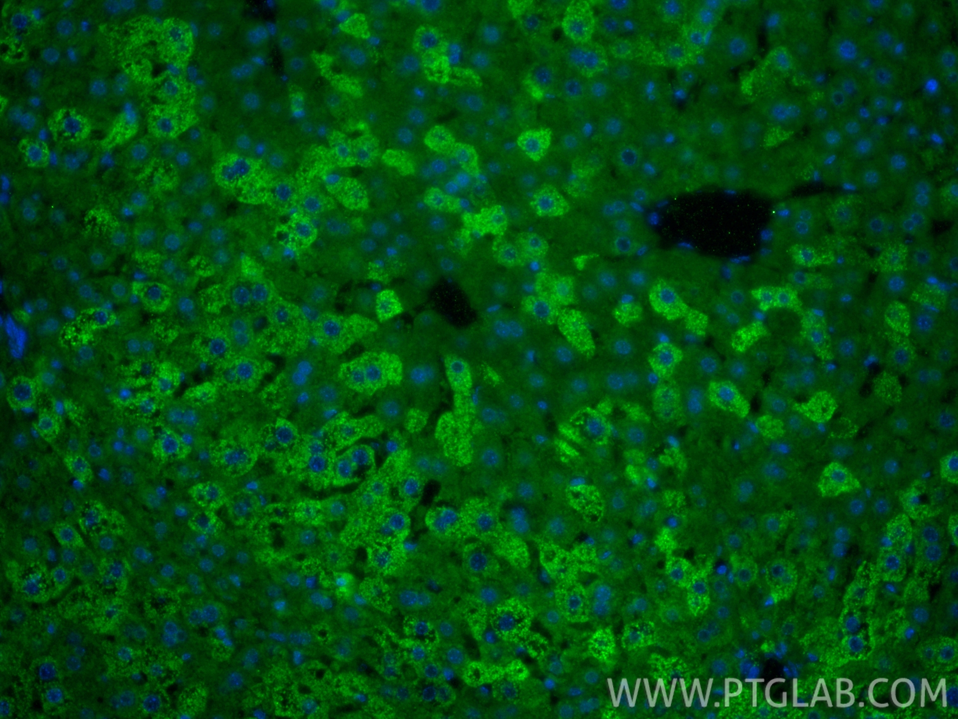 IF Staining of mouse liver using 22762-1-AP IF Staining of mouse liver using 22762-1-AP