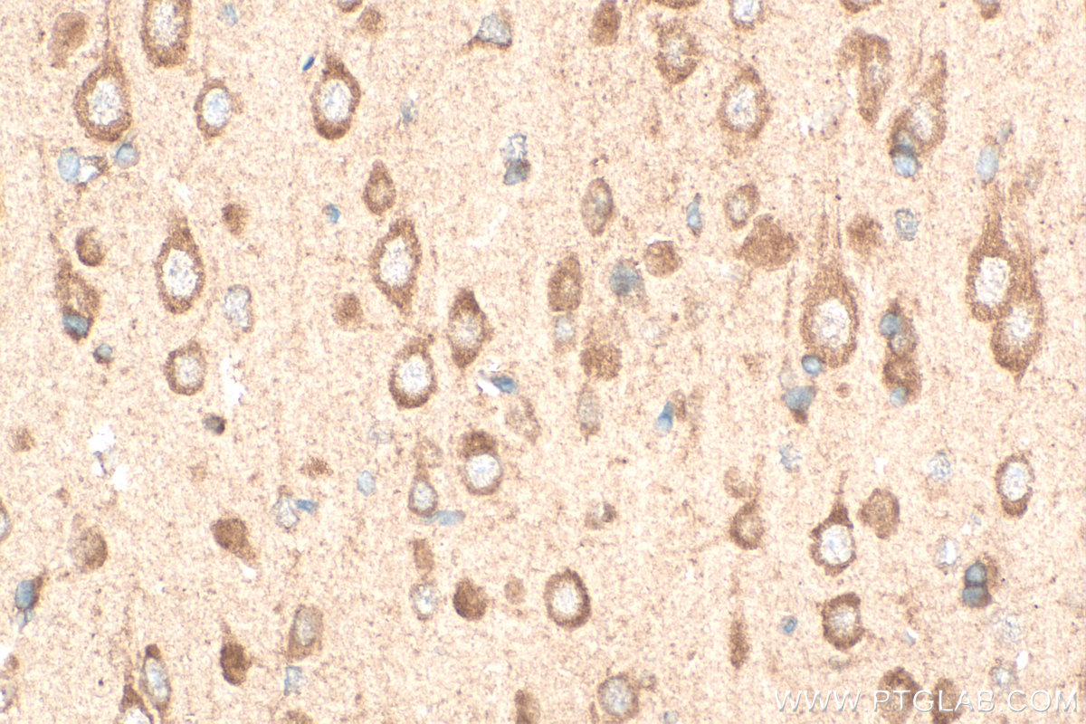 IHC staining of rat brain using 28625-1-AP