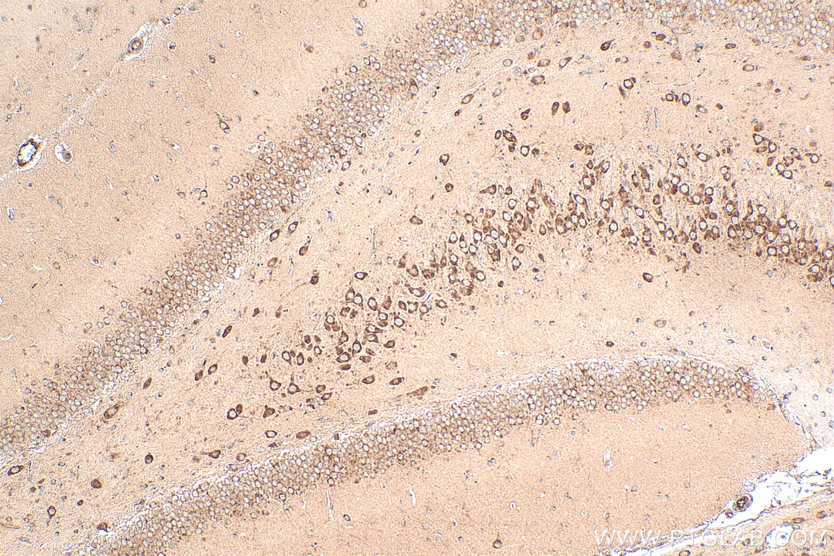 IHC staining of rat brain using 28625-1-AP