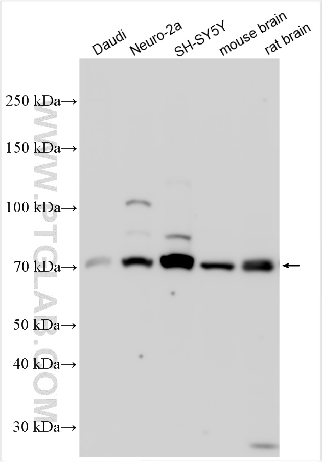 WB analysis using 28625-1-AP