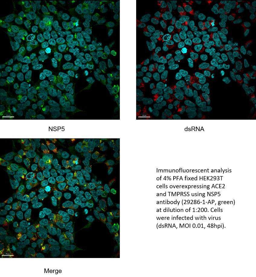 IF Staining of HEK-293T using 29286-1-AP