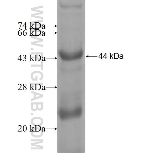 SARS fusion protein Ag7858 SDS-PAGE