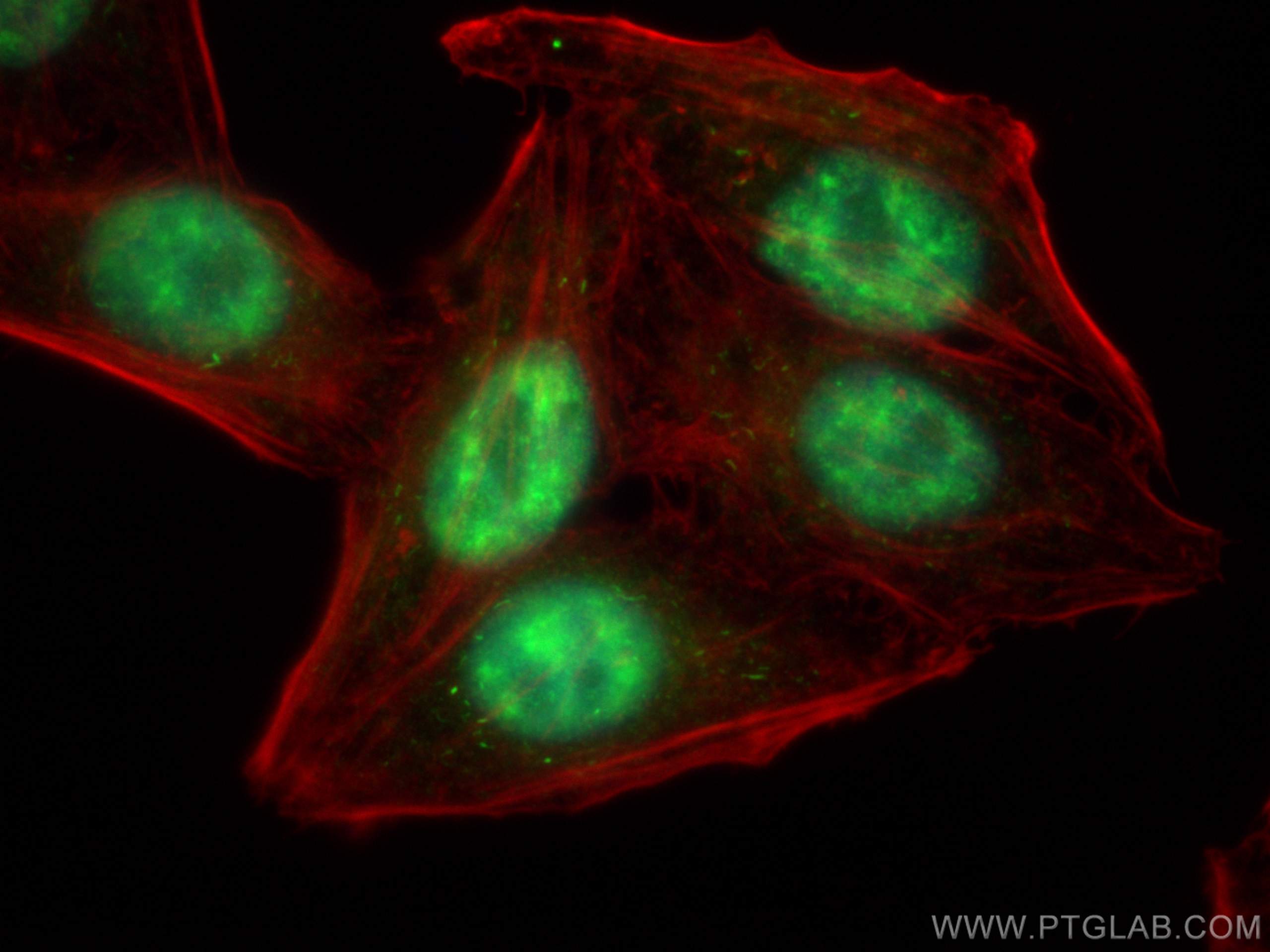 IF Staining of HepG2 using 22675-1-AP
