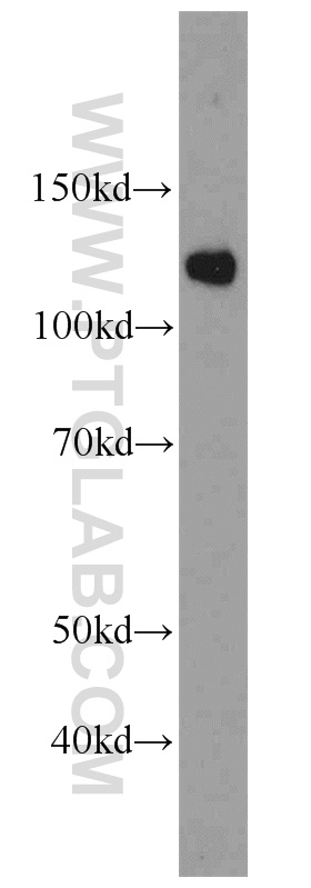 WB analysis of HeLa using 22675-1-AP