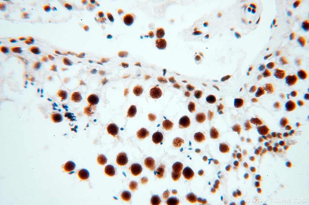 IHC staining of human testis using 18025-1-AP