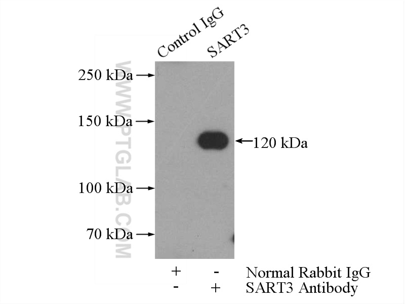 IP experiment of HeLa using 18025-1-AP