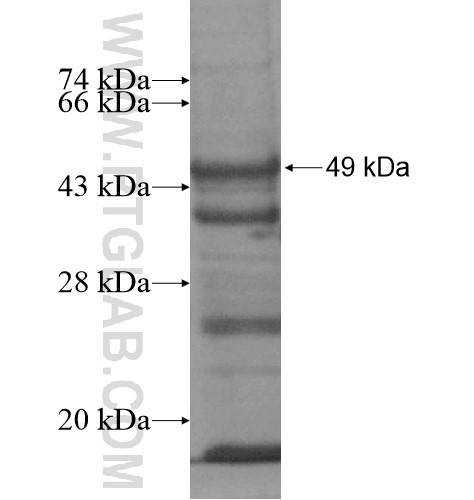 SART3 fusion protein Ag13277 SDS-PAGE SART3 fusion protein Ag13277 SDS-PAGE