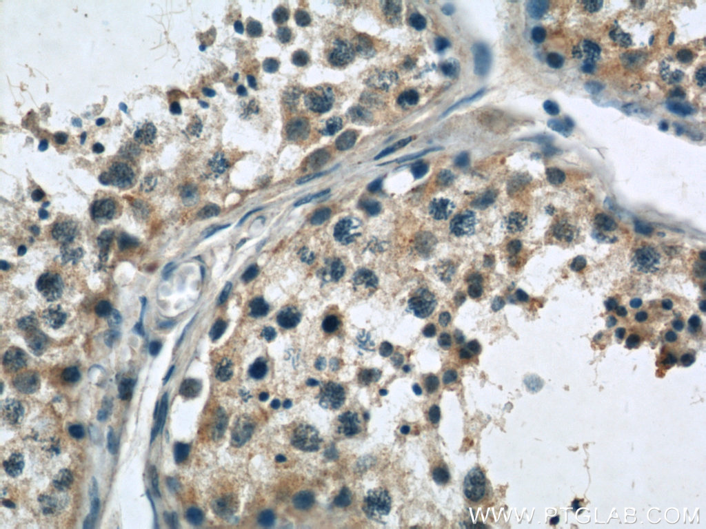 IHC staining of human testis using 21377-1-AP