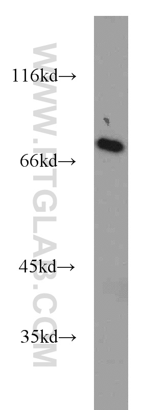 SASS6 Polyclonal antibody