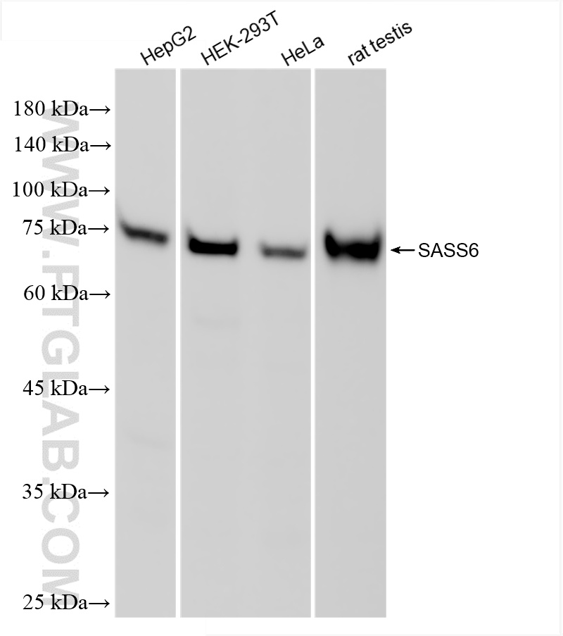 WB analysis using 86251-1-RR