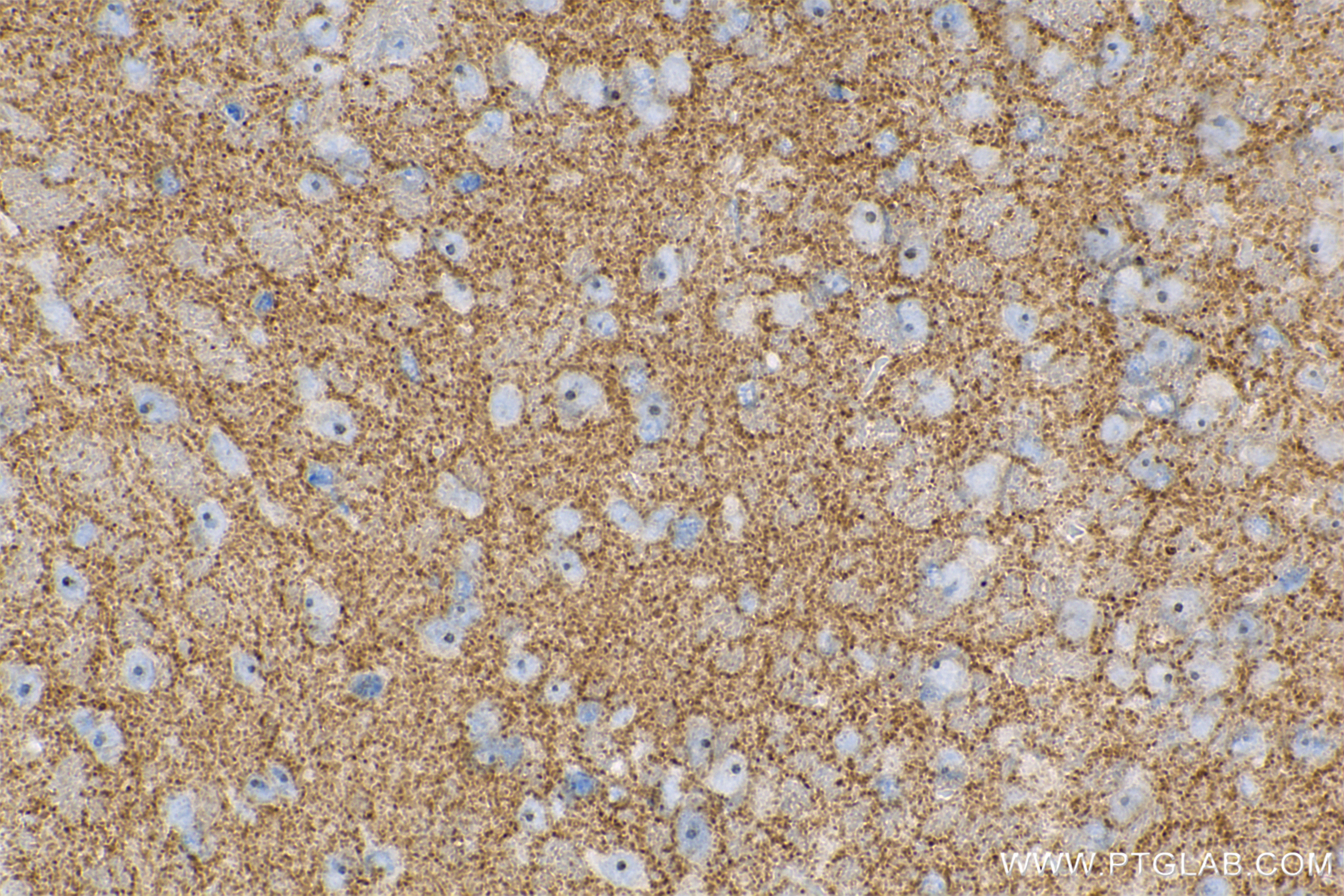 IHC staining of mouse brain using 83319-1-RR (same clone as 83319-1-PBS)
