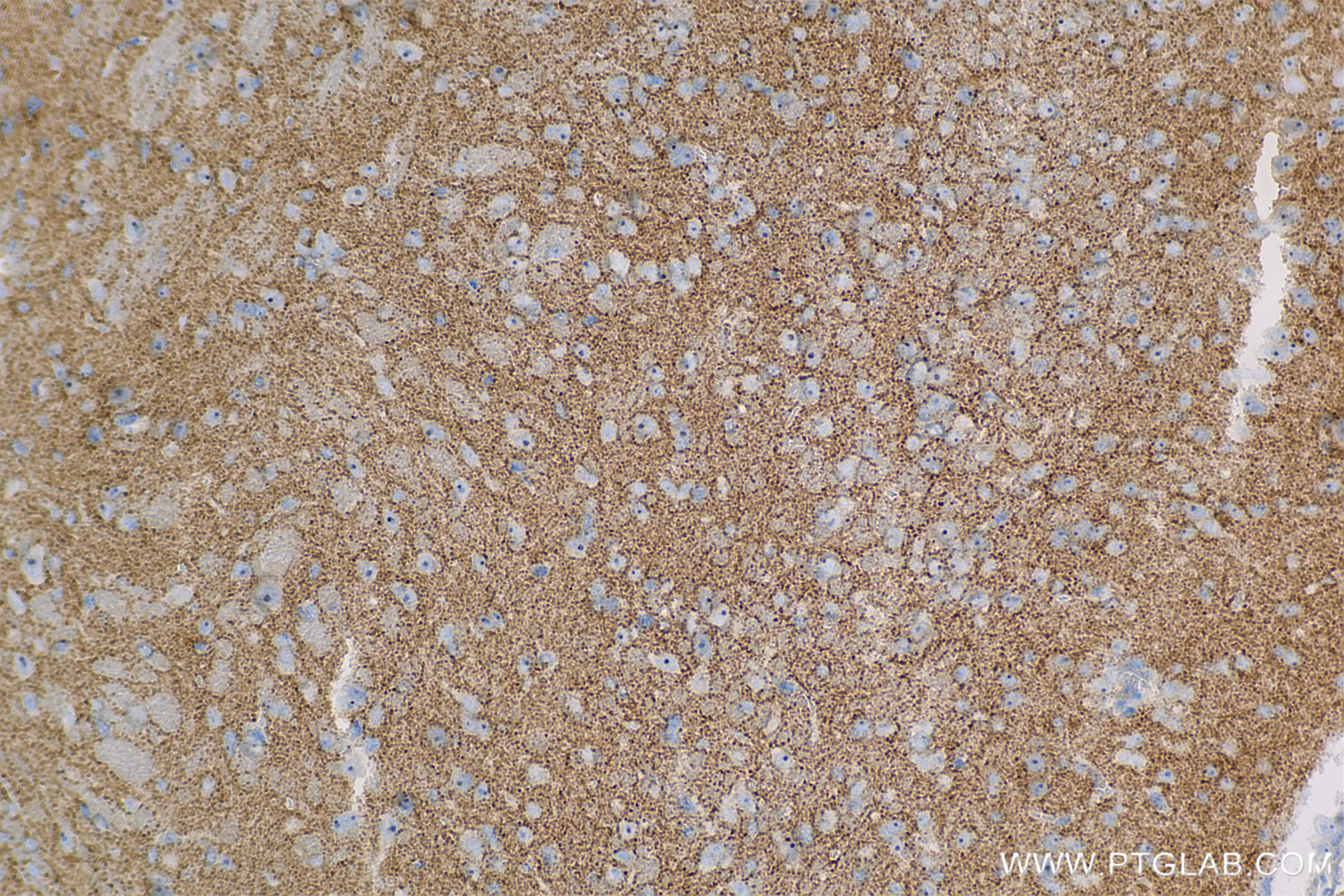 IHC staining of mouse brain using 83319-1-RR (same clone as 83319-1-PBS)
